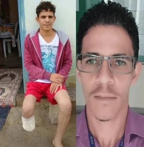 Homem é condenado na Bahia por cortar o próprio pé para tentar receber seguro de R$ 1,5 milhão
