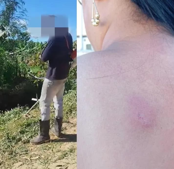 Prefeitura de Itamari não fornece Equipamento de Segurança e mulher acaba ferida durante serviço de roçagem no município