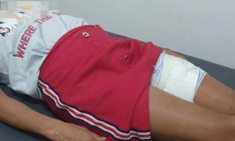 Mulher fica gravemente ferida após ser atacada por cachorro em Apuarema