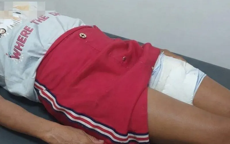 Mulher fica gravemente ferida após ser atacada por cachorro em Apuarema